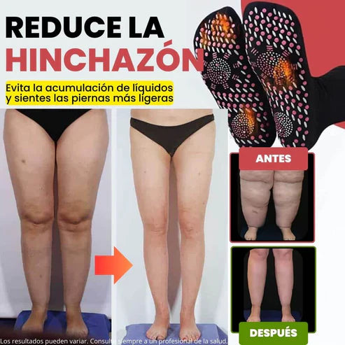 Elimina las Varices con los Calcetines CALVIX (OFERTA 2x1)