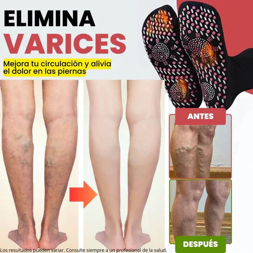 Elimina las Varices con los Calcetines CALVIX (OFERTA 2x1)