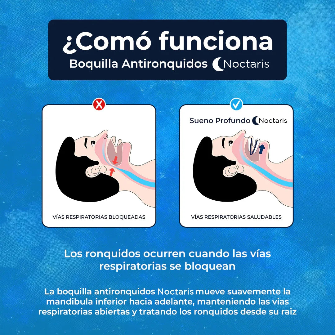 Kit Antironquidos Noctaris™ • El descanso que cambia tu día